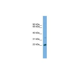Human 293T