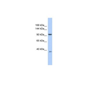 Human OVCAR-3