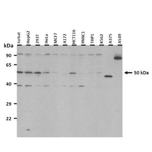 Western Blot