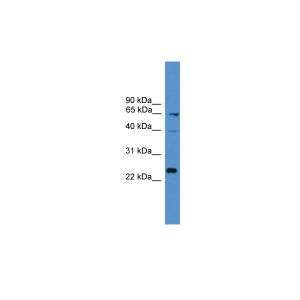 Human MCF-7