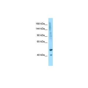 Human OVCAR-3