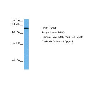 Human NCI-H226 Whole Cell