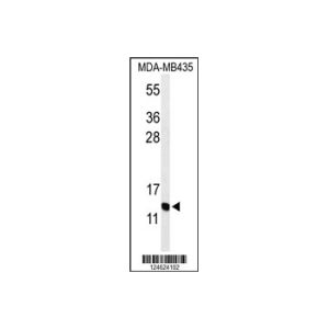 MDA-MB435