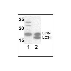 Y79, 293 transfected with human LC3