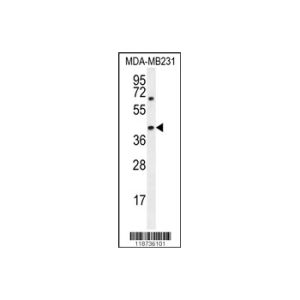 MDA-MB231