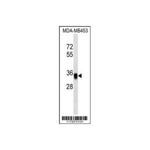 MDA-MB453