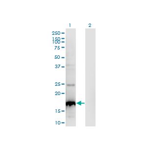 Transfected 293T cell line