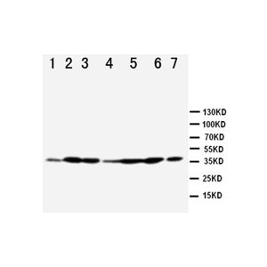 Rat Testicle,Lung, ovary, MCF-7, SMMC, A549, Jurkat,