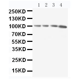 Rat Thymus Tissue Lysate, Rat Spleen Tissue Lysate, Rat RAJI Tissue Lysate, HL-60 Cell Lysate