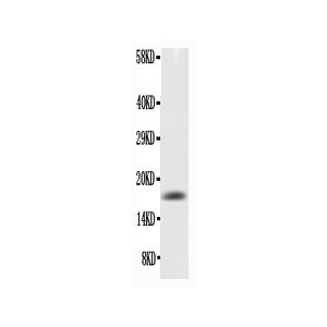 Recombinant Mouse GM-CSF Protein