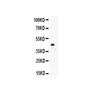 Recombinant Human TRFC Protein