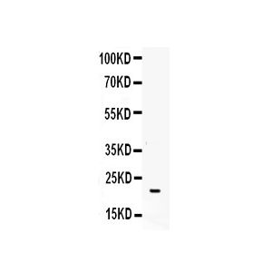 K562 Whole Cell Lysate