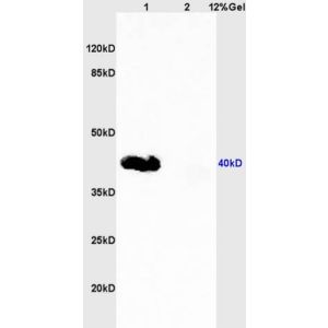 Lane 1: human colon carcinoma lysates Lane 2: rat lung lysates