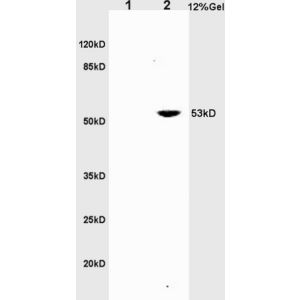 L1 rat brain lysates L2 rat liver lysates