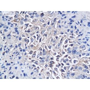 Mouse hepatic tumor