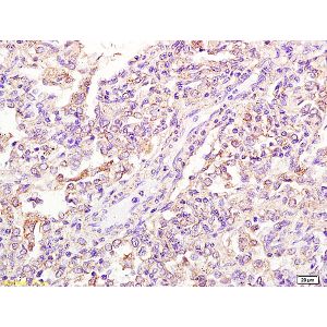 Human pneumonitis tissue