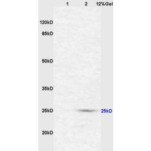 Lane 1: mouse intestine lysates Lane 2: mouse liver lysates