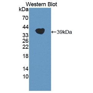 Apolipoprotein(a)