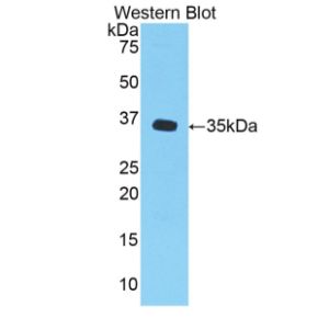 Growth-regulated alpha protein