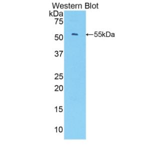 Growth-regulated alpha protein