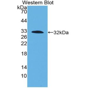 Tissue factor