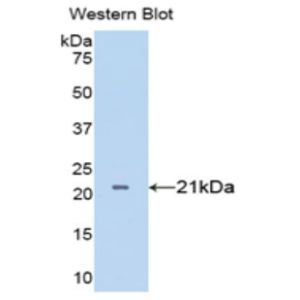 Tumor necrosis factor