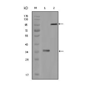 Truncated LPA-His recombinant protein (1) and truncated Trx-LPA (aa4330-4521) recombinant protein (2)