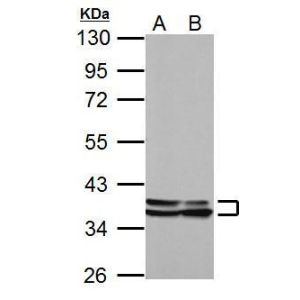 NIH-3T3, JC