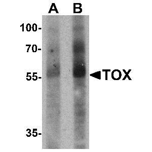 Colon tissue lysate