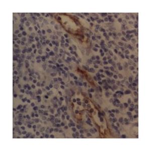 Human Tonsil