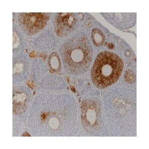 Ovary