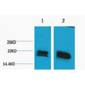 Western Blot