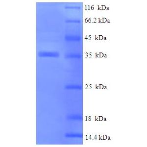 Protein SDS-PAGE