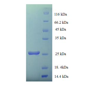 Protein SDS-PAGE