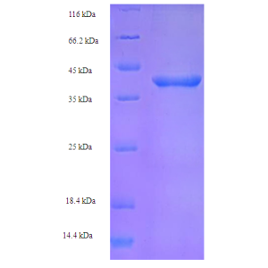 Protein SDS-PAGE