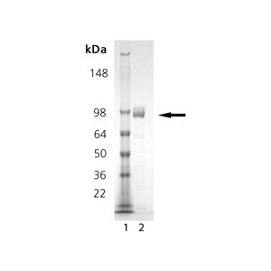 Dipeptidyl peptidase 4 SDS-PAGE 
