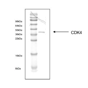 human CDK4