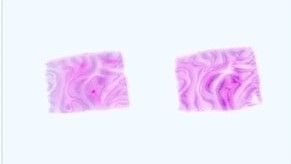 CancerSeq™ AMS Paraffin Tissue Curl