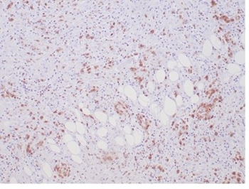 ALK Antibody