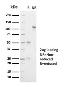 ALK Antibody