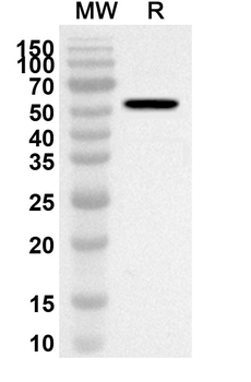 Nipah virus/HeV G protein/Glycoprotein G Rabbit Polyclonal Antibody