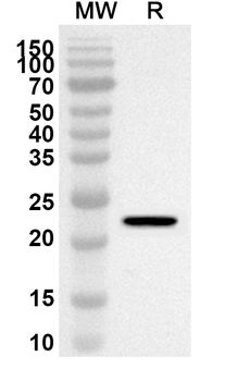 CD130/IL6ST Rabbit Polyclonal Antibody