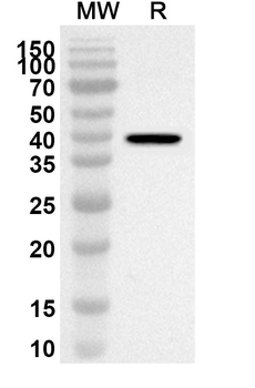 LDHB Rabbit Polyclonal Antibody