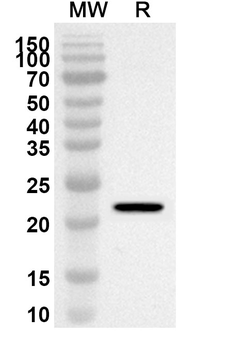 Chicken Allergen Gal d I Rabbit Polyclonal Antibody
