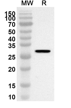 Bordetella pertussis ptxA/PTXS1 Rabbit Polyclonal Antibody