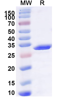 Recombinant Human LBR Protein, N-GST & C-His