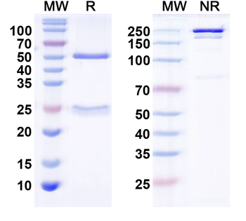 TGFB2/TGF-beta-2 Human Monoclonal Antibody