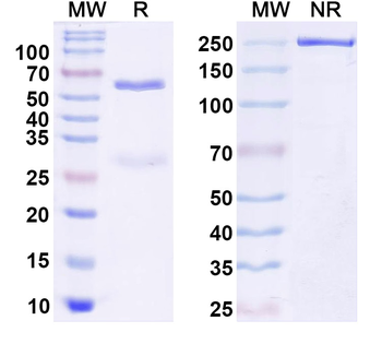 CSF2/GM-CSF Human Monoclonal Antibody