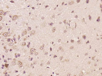 Calcineurin B Rabbit Polyclonal Antibody
