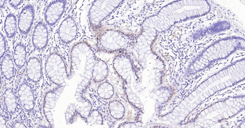 Human SOD1 Ready-To-Use IHC Kit